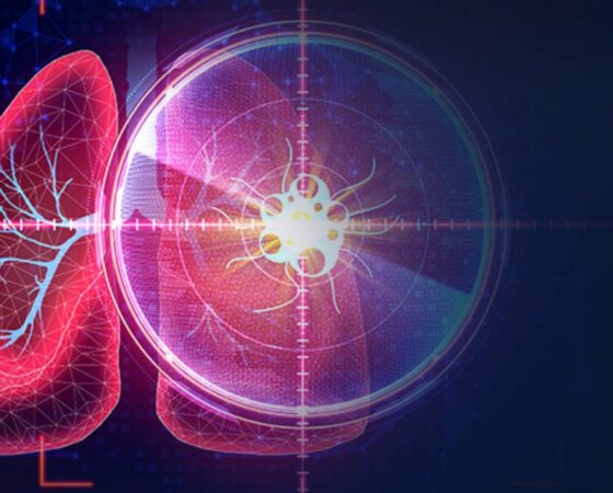 Warsztaty dla radiologów